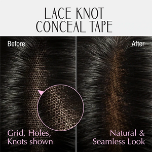 RED Scalp Tape